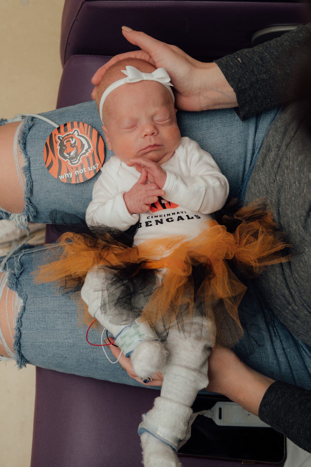 Dayton Children's Hospital is on the Bengals bandwagon